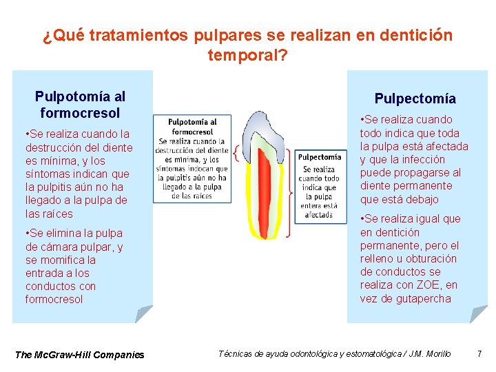 ¿Qué tratamientos pulpares se realizan en dentición temporal? Pulpotomía al formocresol • Se realiza