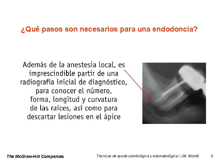 ¿Qué pasos son necesarios para una endodoncia? The Mc. Graw-Hill Companies Técnicas de ayuda