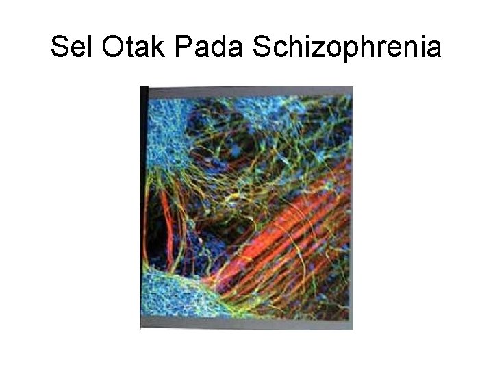 Sel Otak Pada Schizophrenia 