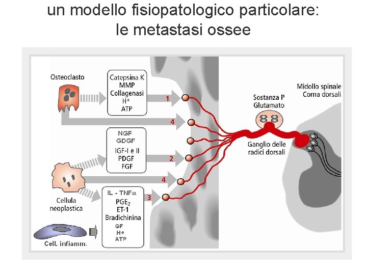 un modello fisiopatologico particolare: le metastasi ossee un modello fisiopatologico particolare: le metastasi ossee