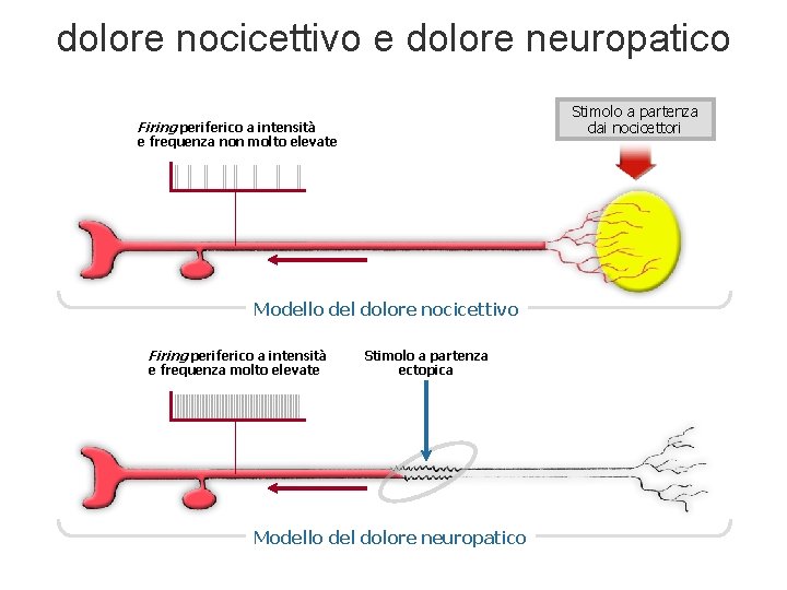 dolore nocicettivo e dolore neuropatico Stimolo a partenza dai nocicettori Firing periferico a intensità dolore nocicettivo e dolore neuropatico Stimolo a partenza dai nocicettori Firing periferico a intensità