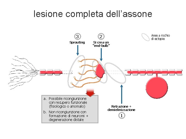 lesione completa dell’assone 3 2 Sprouting Si crea un “end-bulb” a. Possibile ricongiunzione con lesione completa dell’assone 3 2 Sprouting Si crea un “end-bulb” a. Possibile ricongiunzione con