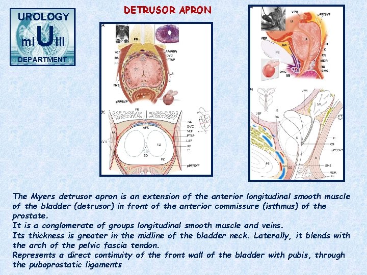 UROLOGY mi DETRUSOR APRON Ulli DEPARTMENT The Myers detrusor apron is an extension of