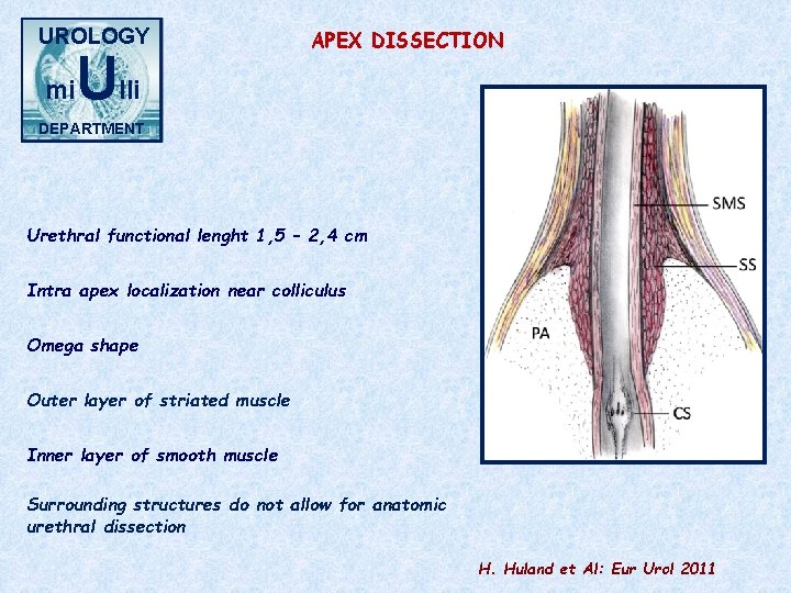 UROLOGY mi Ulli APEX DISSECTION DEPARTMENT Urethral functional lenght 1, 5 – 2, 4