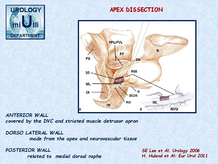 UROLOGY mi Ulli APEX DISSECTION DEPARTMENT ANTERIOR WALL covered by the DVC and striated