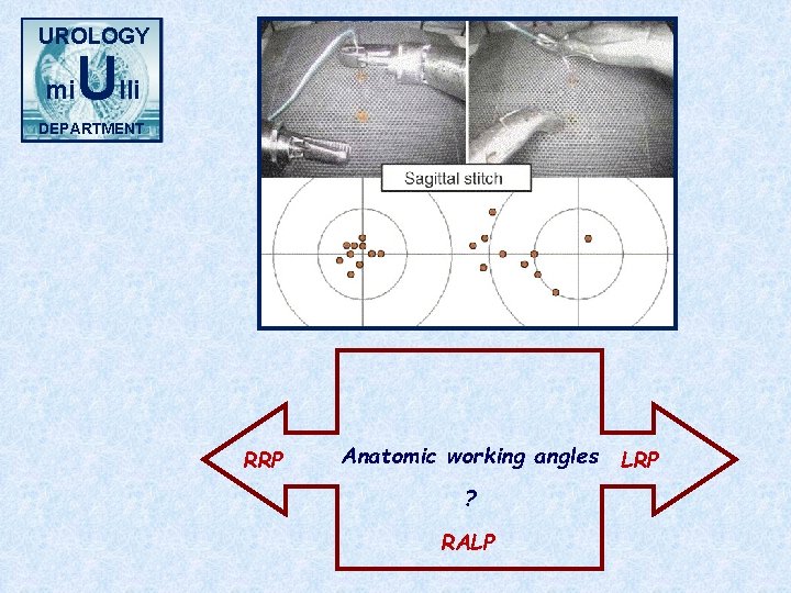 UROLOGY mi Ulli DEPARTMENT RRP Anatomic working angles LRP ? RALP 