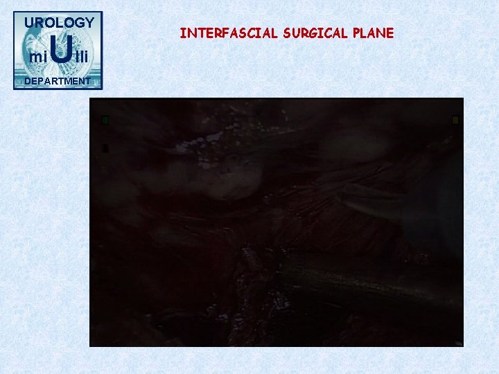 UROLOGY mi Ulli DEPARTMENT INTERFASCIAL SURGICAL PLANE 
