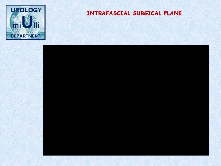 UROLOGY mi Ulli DEPARTMENT INTRAFASCIAL SURGICAL PLANE 