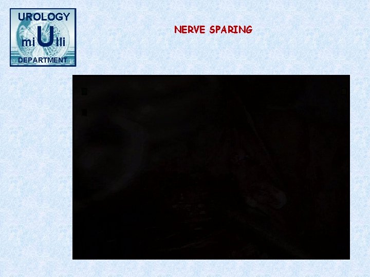 UROLOGY mi Ulli DEPARTMENT NERVE SPARING 
