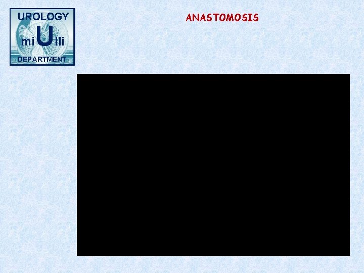 UROLOGY mi Ulli DEPARTMENT ANASTOMOSIS 