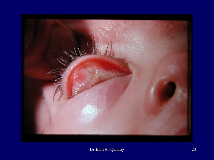 Dr Isam Al-Qurainy 20 Dr Isam Al-Qurainy 20