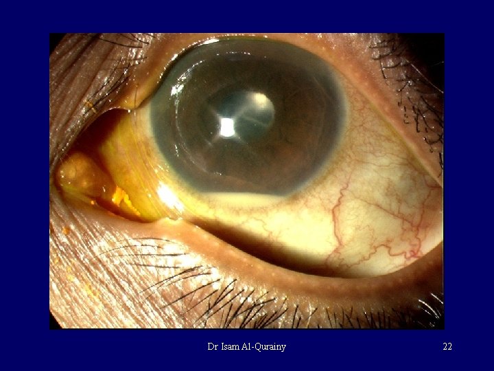 Dr Isam Al-Qurainy 22 Dr Isam Al-Qurainy 22