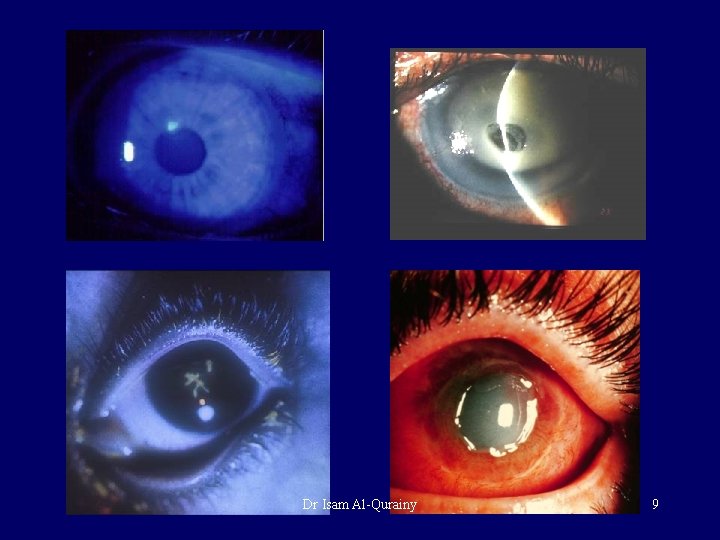 Dr Isam Al-Qurainy 9 Dr Isam Al-Qurainy 9