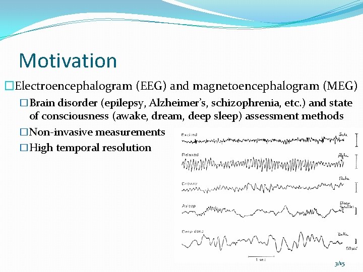 Motivation �Electroencephalogram (EEG) and magnetoencephalogram (MEG) �Brain disorder (epilepsy, Alzheimer’s, schizophrenia, etc. ) and Motivation �Electroencephalogram (EEG) and magnetoencephalogram (MEG) �Brain disorder (epilepsy, Alzheimer’s, schizophrenia, etc. ) and