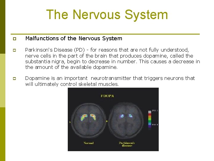 The Nervous System p Malfunctions of the Nervous System p Parkinson's Disease (PD) -