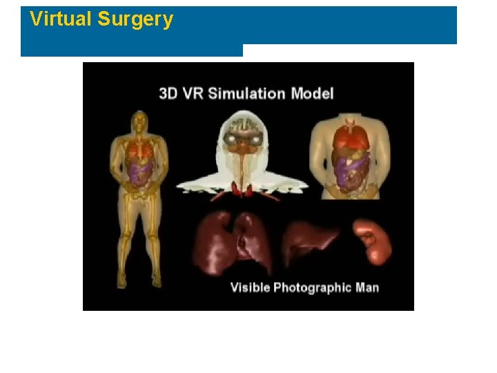 Virtual Surgery 