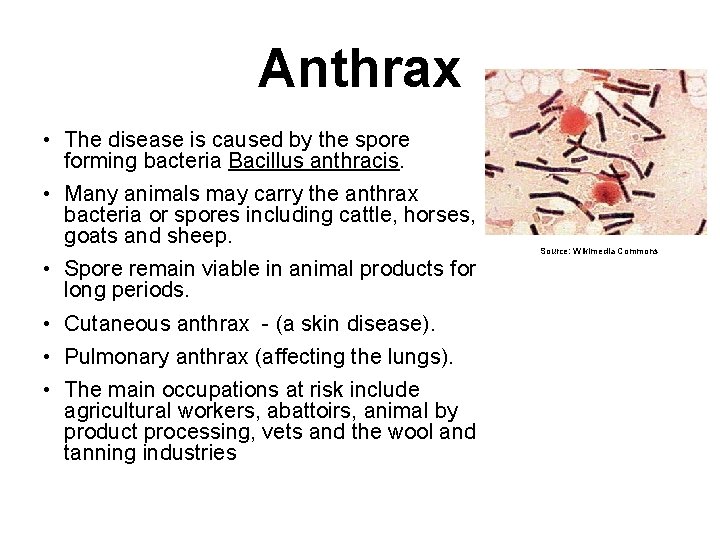 Anthrax • The disease is caused by the spore forming bacteria Bacillus anthracis. •