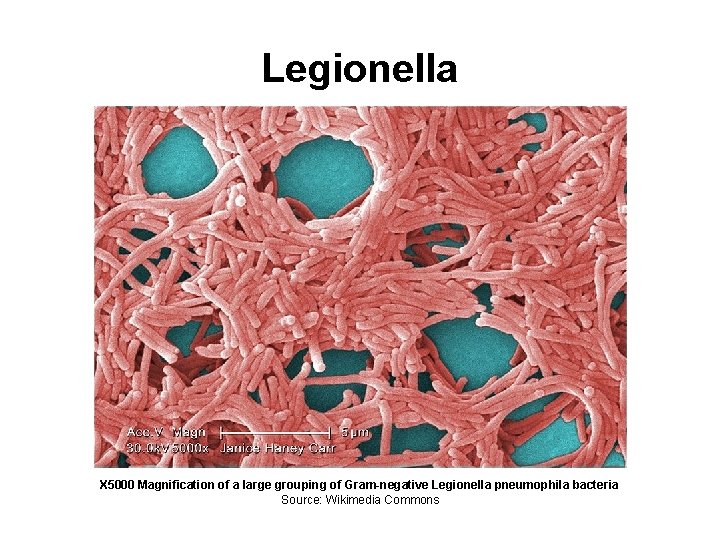 Legionella X 5000 Magnification of a large grouping of Gram-negative Legionella pneumophila bacteria Source: