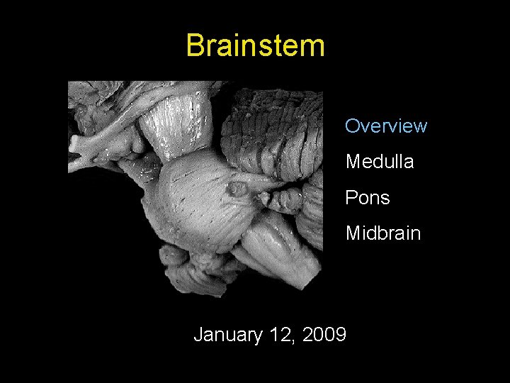 Brainstem Overview Medulla Pons Midbrain January 12, 2009 