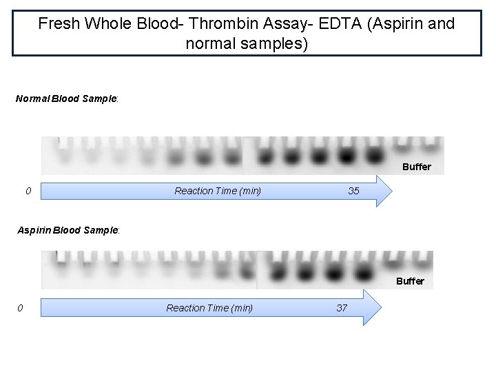 Fresh Whole Blood- Thrombin Assay- EDTA (Aspirin and normal samples) Normal Blood Sample: Buffer