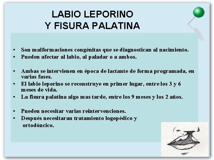 LABIO LEPORINO Y FISURA PALATINA • Son malformaciones congénitas que se diagnostican al nacimiento.