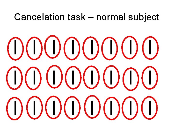 Cancelation task – normal subject Cancelation task – normal subject
