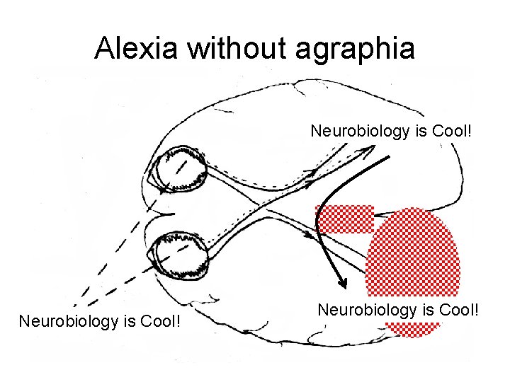 Alexia without agraphia Neurobiology is Cool! ? ? ? ? Alexia without agraphia Neurobiology is Cool! ? ? ? ?