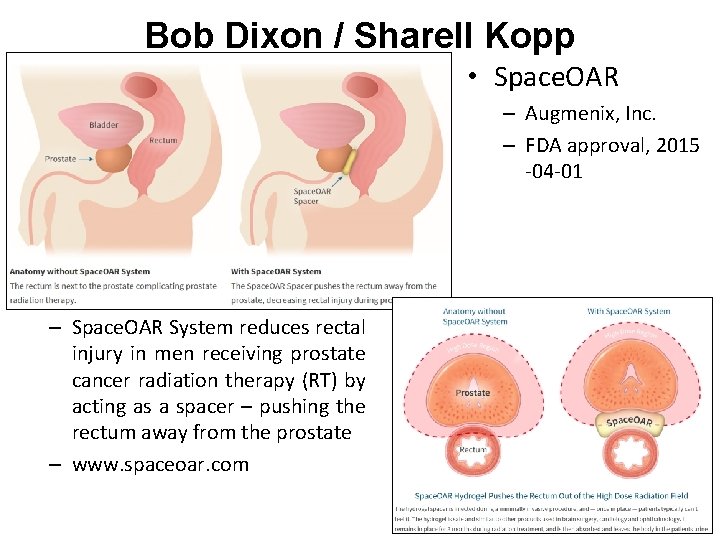 Bob Dixon / Sharell Kopp • Space. OAR – Augmenix, Inc. – FDA approval,