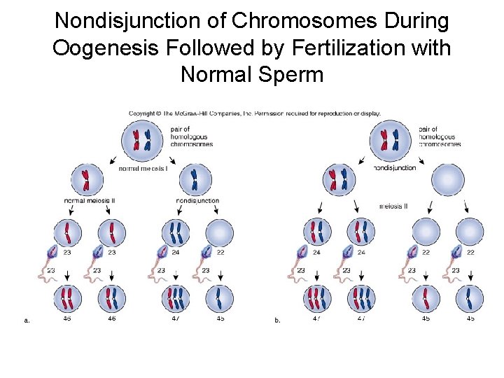 Nondisjunction of Chromosomes During Oogenesis Followed by Fertilization with Normal Sperm 