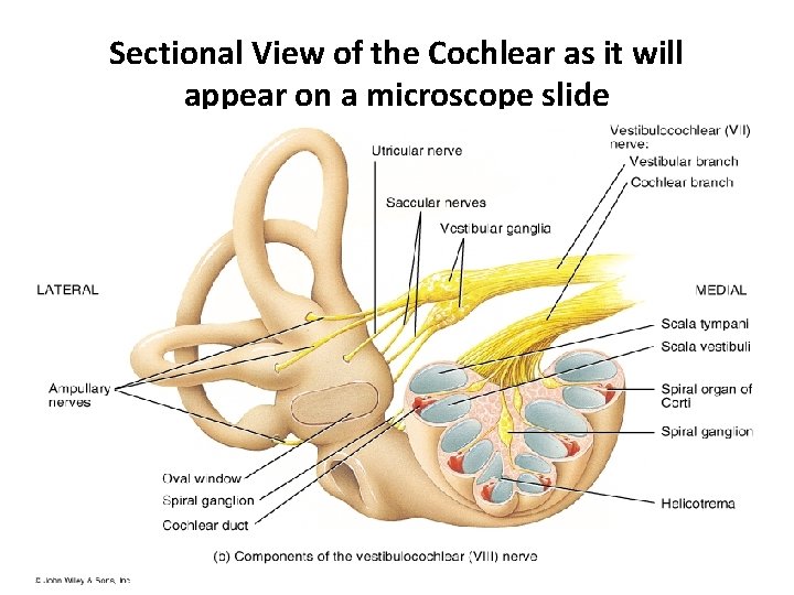 Sectional View of the Cochlear as it will appear on a microscope slide 