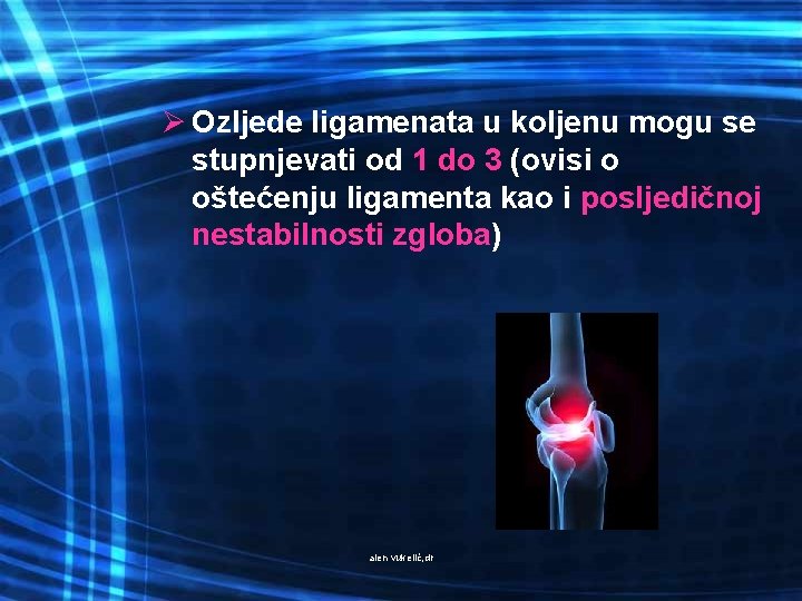 Ø Ozljede ligamenata u koljenu mogu se stupnjevati od 1 do 3 (ovisi o