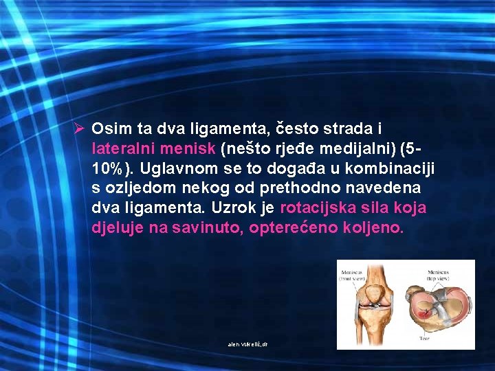 Ø Osim ta dva ligamenta, često strada i lateralni menisk (nešto rjeđe medijalni) (510%).