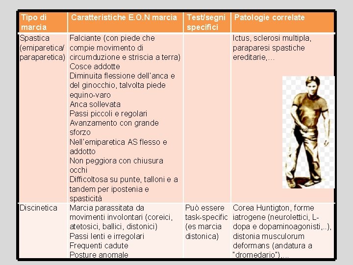 Tipo di marcia Spastica (emiparetica/ paraparetica) Discinetica Caratteristiche E. O. N marcia Test/segni Patologie