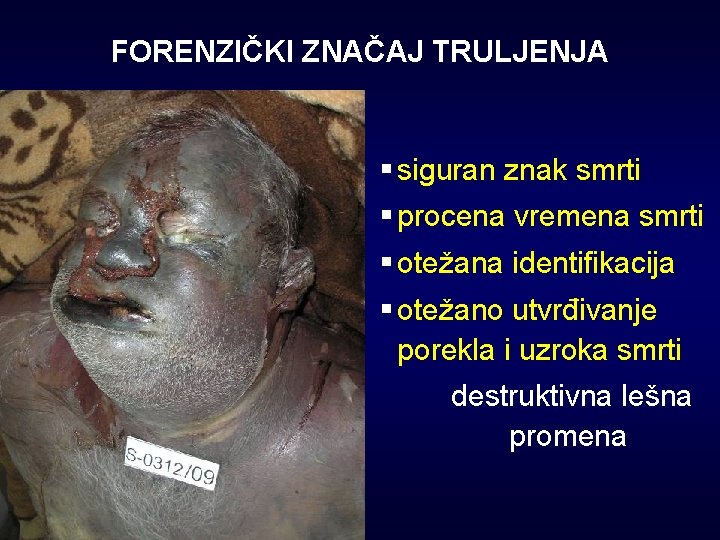 FORENZIČKI ZNAČAJ TRULJENJA § siguran znak smrti § procena vremena smrti § otežana identifikacija