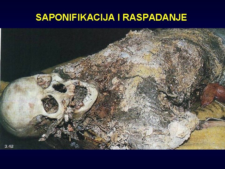 SAPONIFIKACIJA I RASPADANJE 