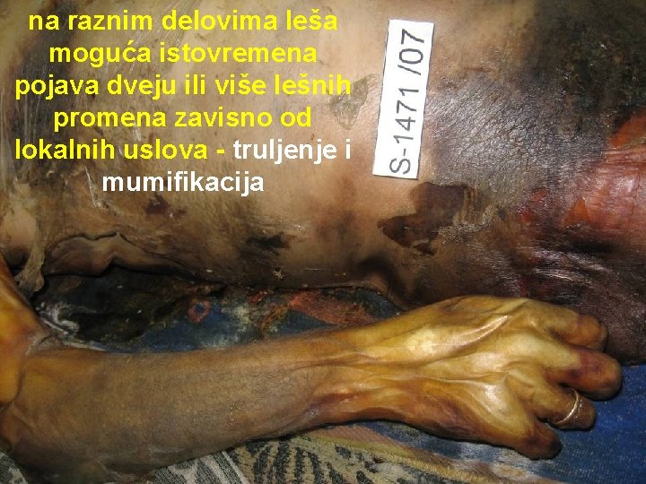 na raznim delovima leša moguća istovremena pojava dveju ili više lešnih promena zavisno od