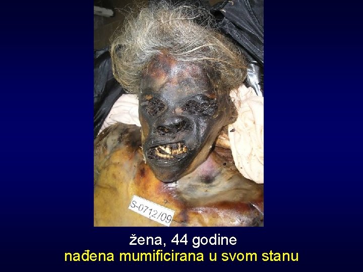 žena, 44 godine nađena mumificirana u svom stanu 