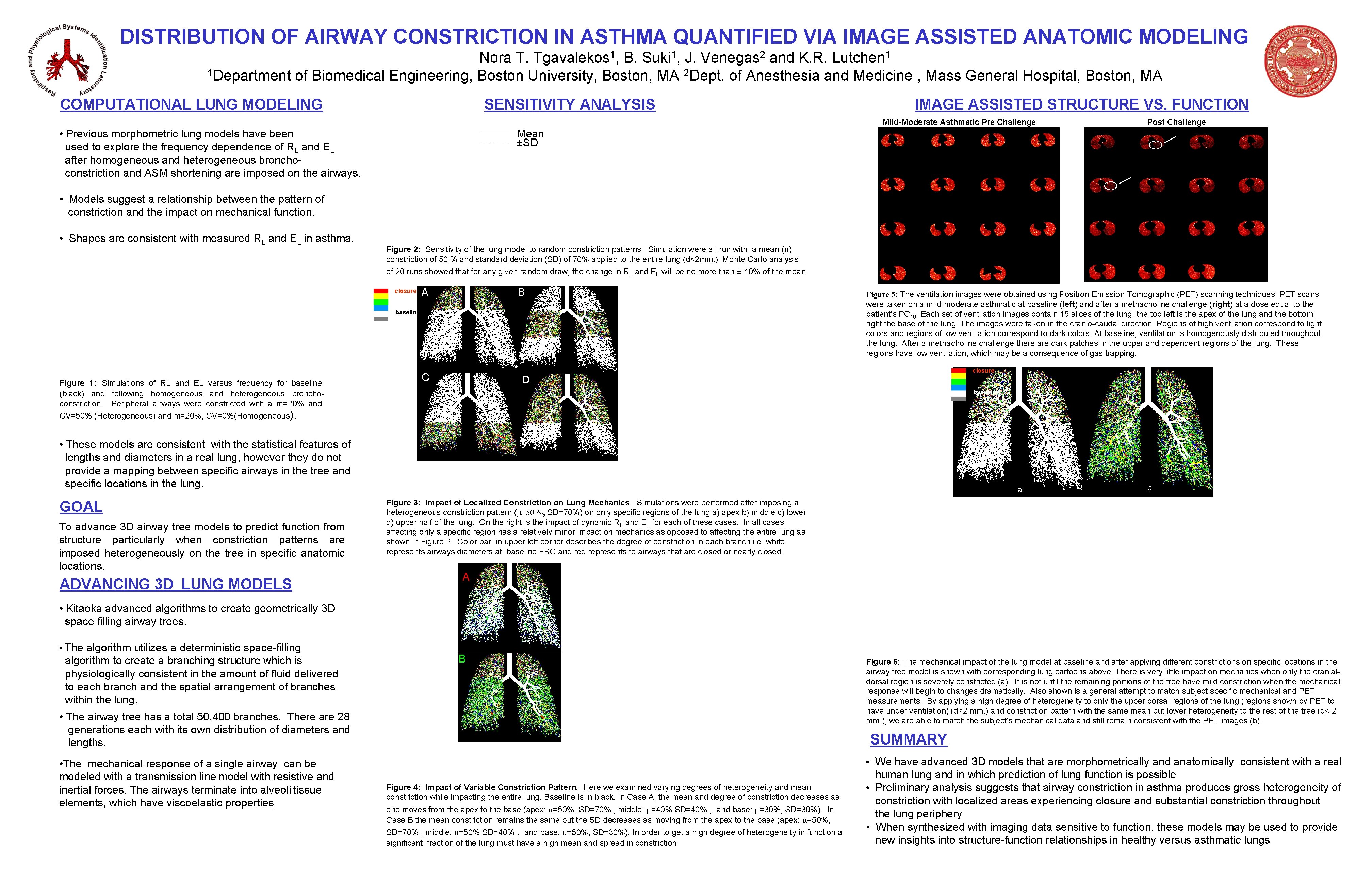 DISTRIBUTION OF AIRWAY CONSTRICTION IN ASTHMA QUANTIFIED VIA IMAGE ASSISTED ANATOMIC MODELING 1 Tgavalekos