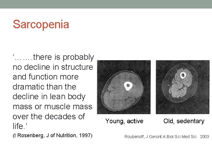Sarcopenia ‘……. there is probably no decline in structure and function more dramatic than