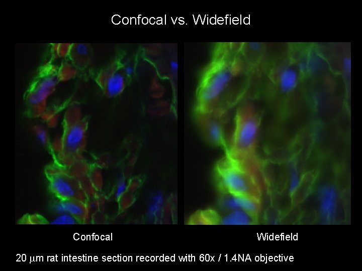 Confocal vs. Widefield Confocal Widefield 20 mm rat intestine section recorded with 60 x