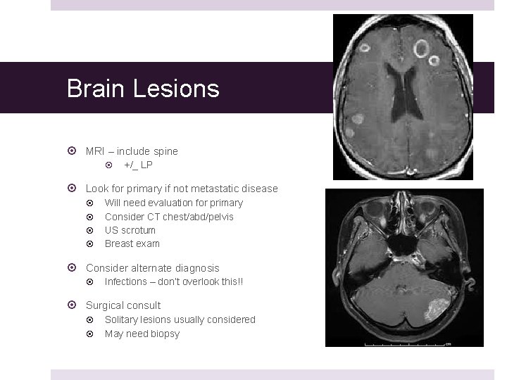 Brain Lesions MRI – include spine +/_ LP Look for primary if not metastatic