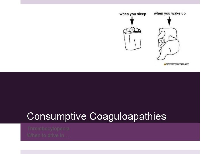 Consumptive Coaguloapathies Thrombocytopenia When to drive in…. 