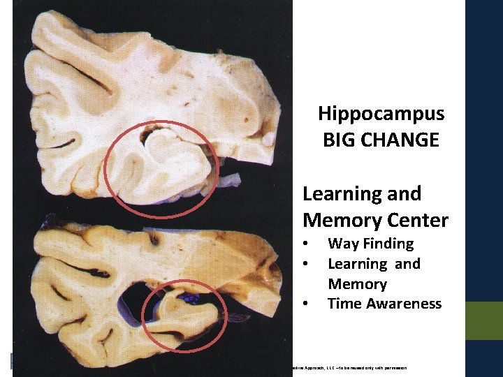 Hippocampus BIG CHANGE Learning and Memory Center • • • Way Finding Learning and