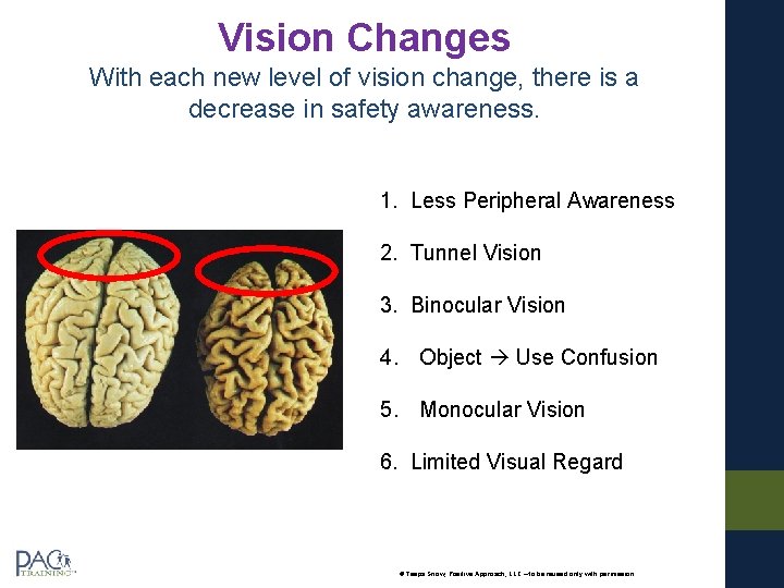 Vision Changes With each new level of vision change, there is a decrease in Vision Changes With each new level of vision change, there is a decrease in