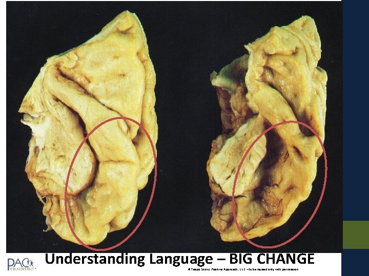 Understanding Language – BIG CHANGE © Teepa Snow, Positive Approach, LLC – to be Understanding Language – BIG CHANGE © Teepa Snow, Positive Approach, LLC – to be