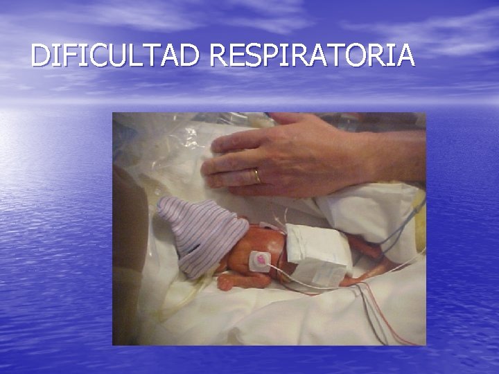 DIFICULTAD RESPIRATORIA 