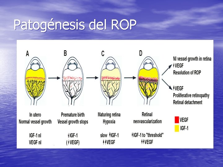 Patogénesis del ROP 