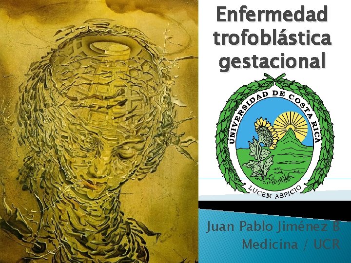 Enfermedad trofoblástica gestacional Juan Pablo Jiménez B Medicina / UCR 