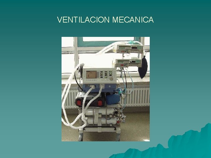 VENTILACION MECANICA 