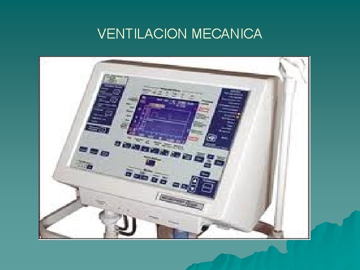 VENTILACION MECANICA 